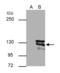 Cadherin 1 antibody, GTX629691, GeneTex, Immunoprecipitation image 