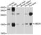 Ubiquitin Conjugating Enzyme E2 N antibody, abx126755, Abbexa, Western Blot image 