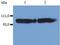 Integrin Subunit Beta 2 antibody, MA1-19007, Invitrogen Antibodies, Western Blot image 