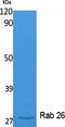 RAB26, Member RAS Oncogene Family antibody, A10670, Boster Biological Technology, Western Blot image 