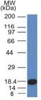c-Kit antibody, MBS439387, MyBioSource, Western Blot image 