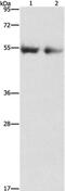 Angiopoietin 4 antibody, PA5-50600, Invitrogen Antibodies, Western Blot image 