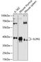 Interleukin 2 Receptor Subunit Gamma antibody, GTX54363, GeneTex, Western Blot image 