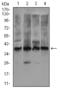 Hyaluronan And Proteoglycan Link Protein 1 antibody, orb247528, Biorbyt, Western Blot image 
