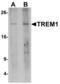 Triggering Receptor Expressed On Myeloid Cells 1 antibody, LS-C201031, Lifespan Biosciences, Western Blot image 