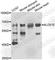 Arachidonate 15-Lipoxygenase antibody, A6864, ABclonal Technology, Western Blot image 