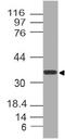 Nucleoporin 35 antibody, A08614, Boster Biological Technology, Western Blot image 