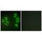 Mitogen-Activated Protein Kinase Kinase Kinase 20 antibody, A00902, Boster Biological Technology, Immunohistochemistry frozen image 