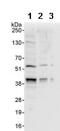 XPA, DNA Damage Recognition And Repair Factor antibody, ab85914, Abcam, Western Blot image 