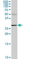 Carbonic Anhydrase 1 antibody, LS-C196792, Lifespan Biosciences, Western Blot image 