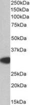 MYD88 Innate Immune Signal Transduction Adaptor antibody, MBS420798, MyBioSource, Western Blot image 