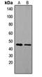Tachykinin Receptor 1 antibody, orb304618, Biorbyt, Western Blot image 