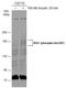Insulin Receptor Substrate 1 antibody, GTX133848, GeneTex, Western Blot image 