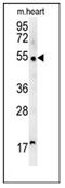 Scavenger Receptor Class A Member 5 antibody, AP53807PU-N, Origene, Western Blot image 