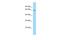 Beta-1,4 N-acetylgalactosaminyltransferase 2 antibody, A07434, Boster Biological Technology, Western Blot image 