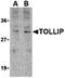 Toll Interacting Protein antibody, orb74694, Biorbyt, Western Blot image 