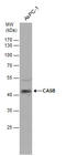 Carbonic Anhydrase 5B antibody, GTX115604, GeneTex, Western Blot image 