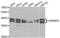 Heterogeneous Nuclear Ribonucleoprotein D antibody, abx004639, Abbexa, Western Blot image 
