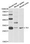 Thymidine Kinase 1 antibody, STJ27579, St John