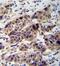 DDB1 And CUL4 Associated Factor 8 Like 2 antibody, PA5-35082, Invitrogen Antibodies, Immunohistochemistry paraffin image 