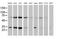 SSX Family Member 1 antibody, MA5-25510, Invitrogen Antibodies, Western Blot image 