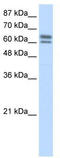 Nucleus Accumbens Associated 1 antibody, TA345485, Origene, Western Blot image 