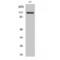 Calcium Voltage-Gated Channel Auxiliary Subunit Alpha2delta 4 antibody, LS-C382379, Lifespan Biosciences, Western Blot image 