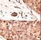 Caudal Type Homeobox 2 antibody, LS-C100379, Lifespan Biosciences, Immunohistochemistry paraffin image 