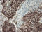 Alcohol Dehydrogenase 7 (Class IV), Mu Or Sigma Polypeptide antibody, LS-B15509, Lifespan Biosciences, Immunohistochemistry paraffin image 