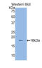 TNF Superfamily Member 13 antibody, LS-C296868, Lifespan Biosciences, Western Blot image 