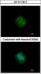 Tankyrase-1 antibody, GTX117417, GeneTex, Immunocytochemistry image 