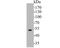 Thymidine Phosphorylase antibody, NBP2-80393, Novus Biologicals, Western Blot image 