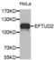 Elongation Factor Tu GTP Binding Domain Containing 2 antibody, abx003187, Abbexa, Western Blot image 
