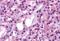 Calcium Sensing Receptor antibody, GTX71753, GeneTex, Immunohistochemistry paraffin image 