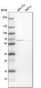 Thioredoxin Related Transmembrane Protein 3 antibody, HPA014157, Atlas Antibodies, Western Blot image 