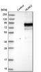 NUAK family SNF1-like kinase 2 antibody, HPA008958, Atlas Antibodies, Western Blot image 