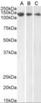 Damage Specific DNA Binding Protein 1 antibody, orb18292, Biorbyt, Western Blot image 