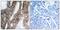 Integrin Subunit Beta 3 antibody, GTX50435, GeneTex, Immunohistochemistry paraffin image 