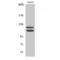 Histone Deacetylase 5 antibody, LS-C384993, Lifespan Biosciences, Western Blot image 
