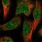 Amylo-Alpha-1, 6-Glucosidase, 4-Alpha-Glucanotransferase antibody, NBP1-89440, Novus Biologicals, Immunofluorescence image 