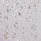 Gamma-Aminobutyric Acid Type A Receptor Gamma3 Subunit antibody, NBP2-30464, Novus Biologicals, Immunohistochemistry frozen image 