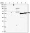 Zinc Finger Protein 543 antibody, PA5-56244, Invitrogen Antibodies, Western Blot image 