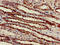ATP Synthase F1 Subunit Beta antibody, LS-C677228, Lifespan Biosciences, Immunohistochemistry paraffin image 