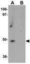 Zinc Finger And BTB Domain Containing 9 antibody, GTX31820, GeneTex, Western Blot image 