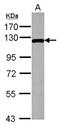 Mitogen-Activated Protein Kinase Kinase Kinase 12 antibody, GTX124127, GeneTex, Western Blot image 