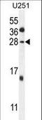 Gamma-Glutamyltransferase Light Chain 2 antibody, LS-C166465, Lifespan Biosciences, Western Blot image 