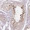 Transcription Factor Like 5 antibody, HPA055223, Atlas Antibodies, Immunohistochemistry frozen image 