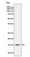 H3 Histone Family Member 3B antibody, P06819-5, Boster Biological Technology, Western Blot image 