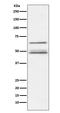 Inhibitor Of Nuclear Factor Kappa B Kinase Regulatory Subunit Gamma antibody, M00874, Boster Biological Technology, Western Blot image 