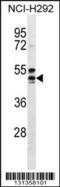 Hydroxycarboxylic Acid Receptor 2 antibody, 56-577, ProSci, Western Blot image 